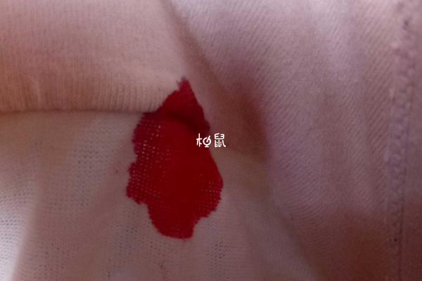 怀男孩孕初期可能会见红