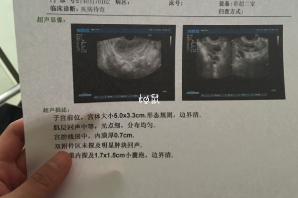 卵泡监测费用要以当地情况为准