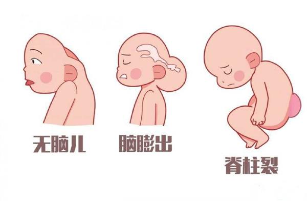 二代试管宝宝畸形率不高