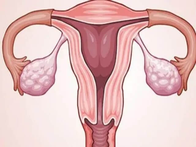试管前做宫腔镜检查可以提高试管成功率