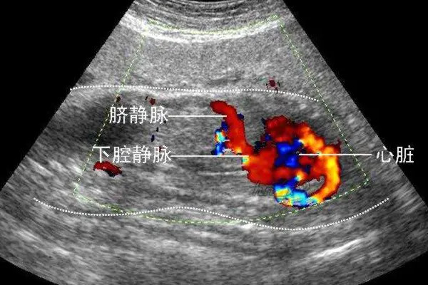 nt三个亮点是男孩女孩